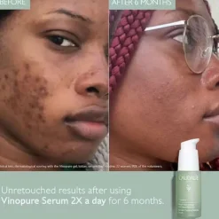CAUDALIE Vinopure Blemish Control Salicylic Serum 30ml