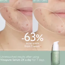 CAUDALIE Vinopure Blemish Control Salicylic Serum 30ml